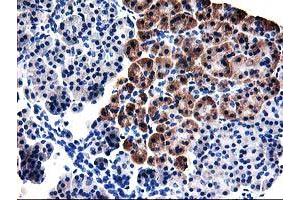 Immunohistochemical staining of paraffin-embedded Human pancreas tissue using anti-TBC1D21 mouse monoclonal antibody. (TBC1D21 antibody)