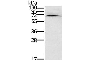 Western Blot analysis of Human normal kidney tissue using CYP11A1 Polyclonal Antibody at dilution of 1:200 (CYP11A1 antibody)