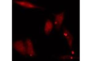 ABIN6275458 staining  HepG2 cells by IF/ICC. (GTR2 antibody  (Internal Region))