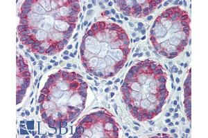 Immunohistochemistry (IHC) image for anti-Anterior Gradient Homolog 2 (Xenopus Laevis) (AGR2) (Internal Region) antibody (ABIN334341)