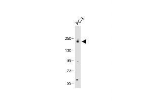 Anti-JLP (SG9) Antibody (N-term) at 1:2000 dilution + PC-3 whole cell lysate Lysates/proteins at 20 μg per lane. (SPAG9 antibody  (N-Term))