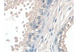 Immunohistochemistry (IHC) image for anti-Coenzyme Q6, Monooxygenase (COQ6) (AA 1-468) antibody (ABIN7444298)
