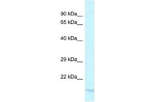 Western Blot showing LY96 antibody used at a concentration of 1 ug/ml against PANC1 Cell Lysate