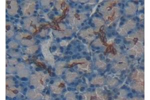 Immunohistochemistry (IHC) image for anti-Tumor Necrosis Factor Receptor Superfamily, Member 11a, NFKB Activator (TNFRSF11A) (AA 31-214) antibody (ABIN7434632)