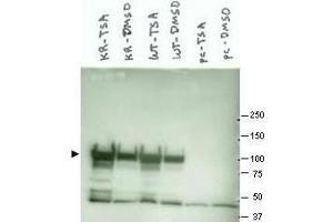 Western blot using  Affinity Purified anti-Hsp90 antibody shows detection of a band at ~90 kDa corresponding to Hsp90 in various lysate preparations (arrowhead).