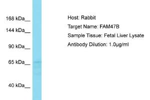 Host: Rabbit Target Name: FAM47B Sample Type: Fetal Liver lysates Antibody Dilution: 1. (FAM47B antibody  (C-Term))