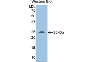 Detection of Recombinant ADRP, Human using Polyclonal Antibody to Adipose Differentiation Related Protein (ADRP) (ADRP antibody  (AA 245-433))