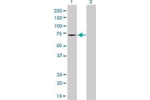 Western Blot analysis of MTM1 expression in transfected 293T cell line by MTM1 monoclonal antibody (M01), clone 1C10. (MTM1 antibody  (AA 1-100))