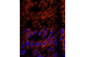 Immunofluorescence analysis of C6 cells using PDE6G antibody (ABIN7269304) at dilution of 1:100. (PDE6G antibody  (AA 1-87))