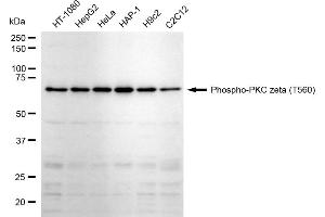 anti-Protein Kinase C, zeta (PRKCZ) (pThr560) antibody