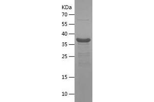 Western Blotting (WB) image for Polymerase (DNA Directed) iota (POLI) (AA 444-740) protein (His tag) (ABIN7124512) (POLI Protein (AA 444-740) (His tag))