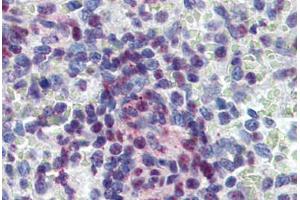 Human Spleen: Formalin-Fixed, Paraffin-Embedded (FFPE) (KDM4C antibody  (C-Term))