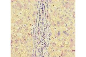 Immunohistochemistry (IHC) image for anti-Apolipoprotein B mRNA Editing Enzyme, Catalytic Polypeptide-Like 3G (APOBEC3G) (AA 1-384) antibody (ABIN7150160)