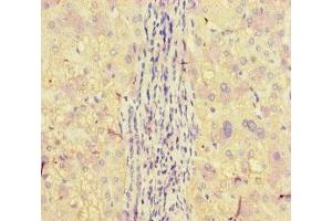 Immunohistochemistry of paraffin-embedded human liver tissue using ABIN7150160 at dilution of 1:100 (APOBEC3G antibody  (AA 1-384))