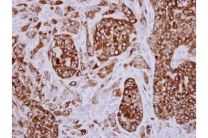 IHC-P Image Immunohistochemical analysis of paraffin-embedded A549 xenograft, using AGR3, antibody at 1:500 dilution. (AGR3 antibody  (Center))