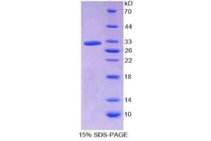 SDS-PAGE of Protein Standard from the Kit  (Highly purified E. (HPR ELISA Kit)