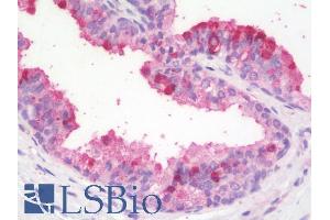 ABIN5539919 (5µg/ml) staining of paraffin embedded Human Prostate. (ZBTB24 antibody  (AA 232-245))