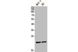Western Blot analysis of MCF7 KB cells using Bax Polyclonal Antibody (BAX antibody  (N-Term))