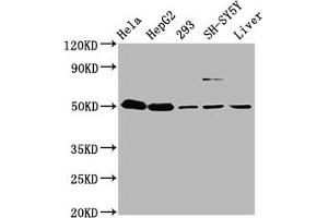 Western Blot Positive WB detected in: Hela whole cell lysate, HepG2 whole cell lysate, 293 whole cell lysate, SH-SY5Y whole cell lysate, Mouse liver tissue All lanes: DYM antibody at 3. (Dymeclin antibody  (AA 224-348))