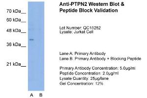 Host:  Rabbit  Target Name:  PTPN2  Sample Type:  Jurkat  Lane A:  Primary Antibody  Lane B:  Primary Antibody + Blocking Peptide  Primary Antibody Concentration:  5. (PTPN2 antibody  (N-Term))