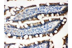 IHC-P testing of rat intestine tissue (Ovalbumin antibody  (AA 1-350))