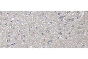Immunohistochemistry of paraffin-embedded Human brain tissue using PRAME Polyclonal Antibody at dilution of 1:65(x200) (PRAME antibody)