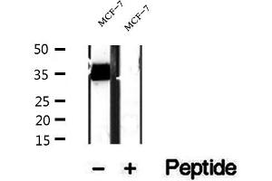 Western blot analysis of extracts of MCF-7 cells, using RQCD1 antibody.