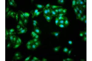 Immunofluorescence staining of HepG2 cells with ABIN7145619 at 1:166, counter-stained with DAPI. (FHIT antibody  (AA 2-147))