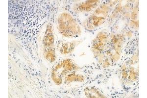 ABIN6261924 and ABIN6266907 at 1/100 staining human normal gastric tissue by IHC-P.