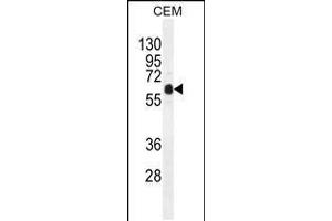 Western blot analysis in CEM cell line lysates (35ug/lane). (DOK3 antibody  (C-Term))