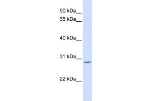 WB Suggested Anti-AEBP2 Antibody Titration: 0. (AEBP2 antibody  (C-Term))
