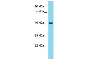 Host: Rabbit Target Name: ARHGEF39 Sample Type: Jurkat Whole Cell lysates Antibody Dilution: 1. (C9orf100 antibody  (C-Term))