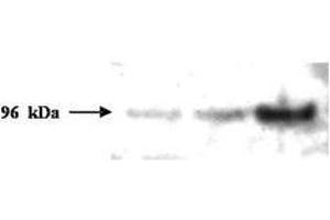 Image no. 1 for anti-PMS2 Postmeiotic Segregation Increased 2 (S. Cerevisiae) (PMS2) (AA 58-81) antibody (ABIN296611) (PMS2 antibody  (AA 58-81))