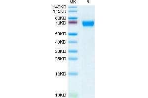 CD46 Protein (CD46) (AA 35-343) (His tag)