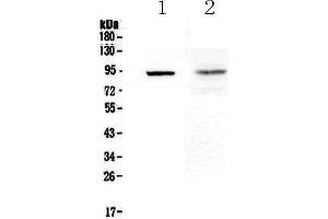 Western blot analysis of TLR1 using anti-TLR1 antibody . (TLR1 antibody  (AA 350-404))