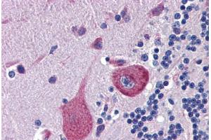 Human Brain, Cerebellum (formalin-fixed, paraffin-embedded) stained with CBLN4 antibody ABIN462251 followed by biotinylated goat anti-rabbit IgG secondary antibody ABIN481713, alkaline phosphatase-streptavidin and chromogen. (CBLN4 antibody  (AA 125-174))