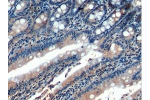 Detection of HCAM in Rat Small intestine Tissue using Polyclonal Antibody to Homing Associated Cell Adhesion Molecule (HCAM) (HCAM antibody  (AA 24-182))