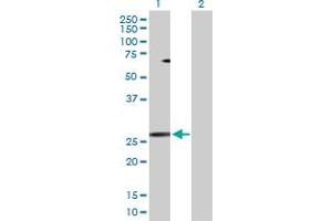 Western Blot analysis of PPP3R1 expression in transfected 293T cell line by PPP3R1 MaxPab polyclonal antibody.