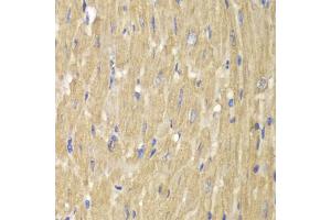 Immunohistochemistry of paraffin-embedded mouse heart using NCF2 antibody (ABIN5970524) at dilution of 1/100 (40x lens). (NCF2 antibody)