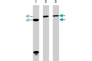 Western blot analysis of Jurkat (lane 1), A-431 (lane 2), and HeLa (lane 3) cell lysates (20 ug/lane). (Neural Wiskott-Aldrich syndrome protein (WASL) (C-Term) antibody)