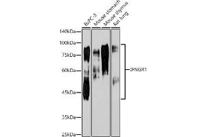Western blot analysis of extracts of various cell lines, using IFNGR1 antibody  at 1:1000 dilution. (IFNGR1 antibody)
