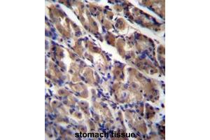 ABRA Antibody (C-term) immunohistochemistry analysis in formalin fixed and paraffin embedded human stomach tissue followed by peroxidase conjugation of the secondary antibody and DAB staining. (ABRA antibody  (C-Term))