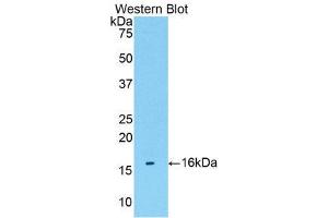 Western Blotting (WB) image for anti-Transmembrane Protein 27 (TMEM27) (AA 17-137) antibody (ABIN1176811) (TMEM27 antibody  (AA 17-137))