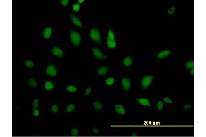Immunofluorescence of purified MaxPab antibody to ERCC2 on HeLa cell. (ERCC2 antibody  (AA 1-760))