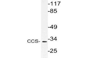 Western blot (WB) analysis of CCS antibody in extracts from Jurkat cells. (Superoxide dismutase copper chaperone antibody)