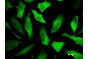 Immunofluorescence of monoclonal antibody to DPYSL5 on HeLa cell. (DPYSL5 antibody  (AA 1-564))