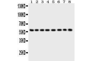 Anti- P2X2 Picoband antibody, Western blotting All lanes: Anti P2X2  at 0. (P2RX2 antibody  (AA 139-471))