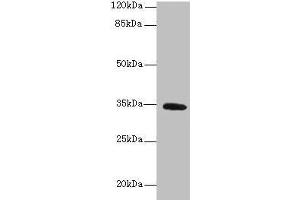 Western blot All lanes: SETD9 antibody at 6 μg/mL + K562 whole cell lysate Secondary Goat polyclonal to rabbit IgG at 1/10000 dilution Predicted band size: 35, 31 kDa Observed band size: 35 kDa (C5orf35 antibody  (AA 1-299))
