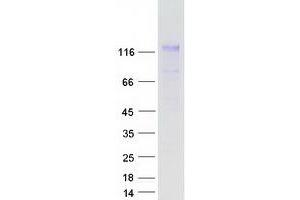 Western Blotting (WB) image for Nuclear Factor of Activated T-Cells, Cytoplasmic, Calcineurin-Dependent 2 (NFAT1) (Transcript Variant 1) protein (Myc-DYKDDDDK Tag) (ABIN2727214)