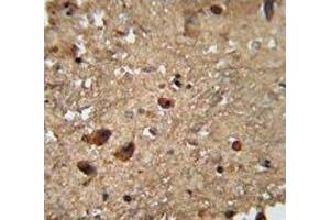 RAN antibody immunohistochemistry analysis in formalin fixed and paraffin embedded human brain tissue. (RAN antibody  (AA 112-140))